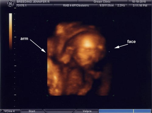 Baby-Y-05