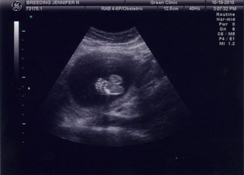 Baby-Y-06